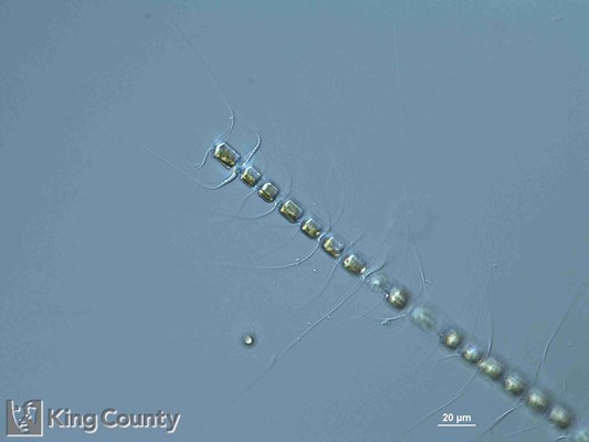 Photo of Chaetoceros crucifer